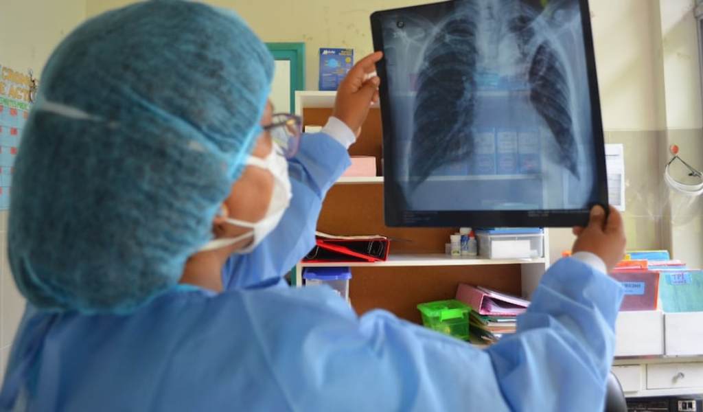 Tuberculosis y ajuste: Denuncian aumento de contagios y muertes