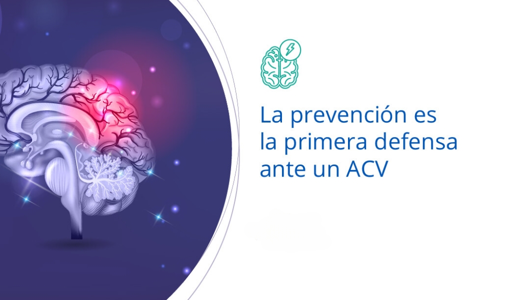 Aumentaron los casos de ACV (accidentes cerebrovasculares) en Salta