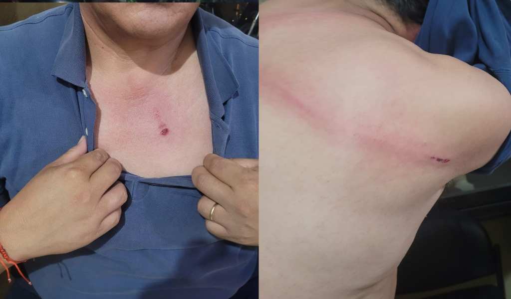 Reincidente y violento: Vendedor de pochoclos agredió con una cadena y por la espalda a un inspector municipal en Plaza 9 de Julio