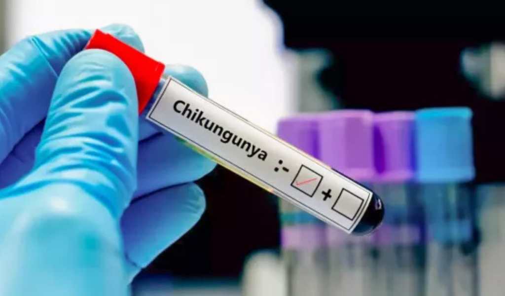 Chikungunya "la enfermedad que te encorva del dolor":  En Salta ascienden a 413 los casos confirmados