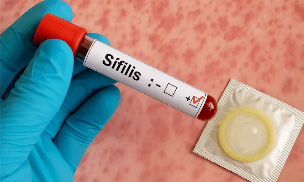 La sífilis alcanza un máximo histórico en Argentina: Los contagios crecieron más del 20% en lo que va del año