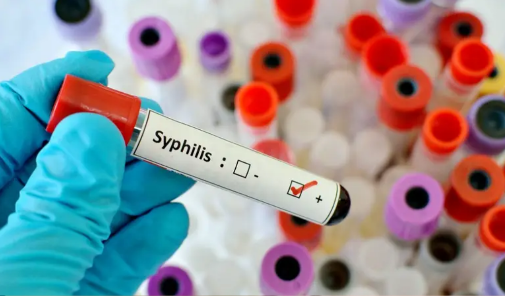 En 2025, los casos de sífilis en Argentina crecieron un 20,5% respecto al año anterior: Los jóvenes de entre 15 y 39 años los más afectados