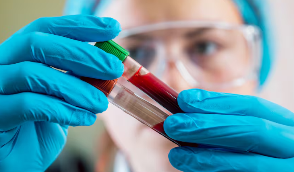 IPS  sancionará a bioquímicos que cobren plus a los afiliados: "Se ejercerá acciones administrativas y legales"