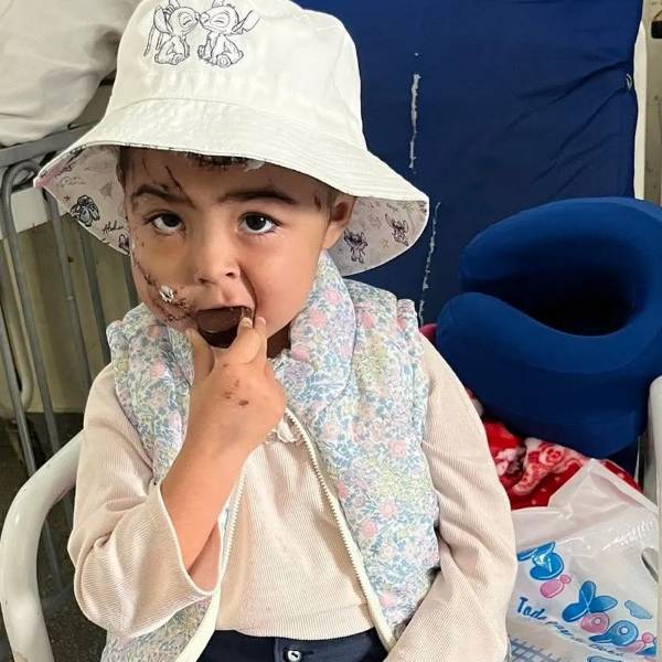 Pilar, la nena de 3 años atacada por un pitbull en Metán, recibió el alta: 