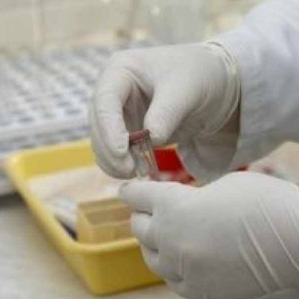 Exámenes toxicológicos para funcionarios: 