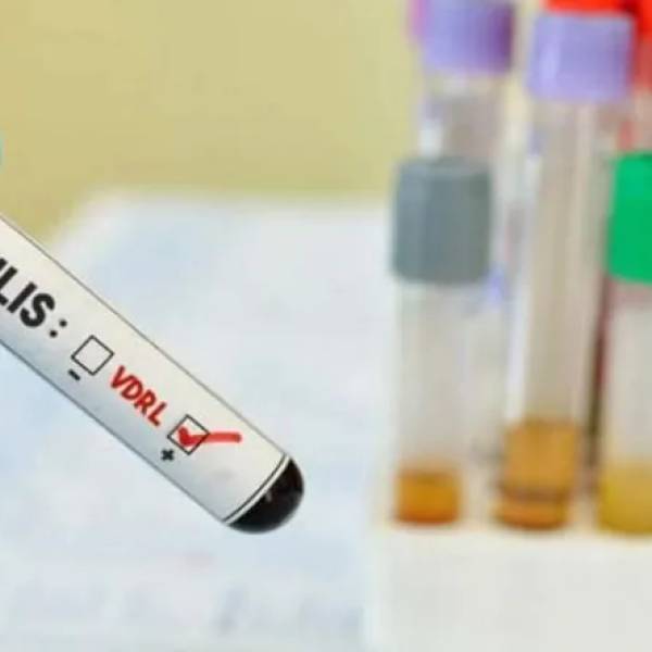 Récord histórico de sífilis en la Argentina: Los contagios aumentaron 38,5% por la falta de prevención