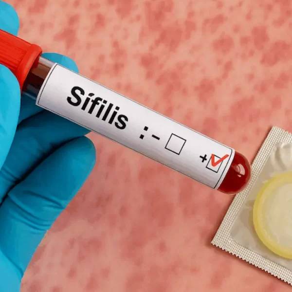 La sífilis alcanza un máximo histórico en Argentina: Los contagios crecieron más del 20% en lo que va del año