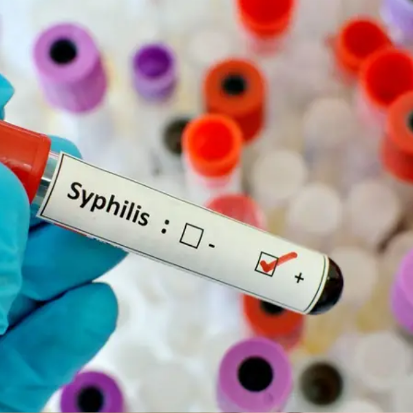 En 2025, los casos de sífilis en Argentina crecieron un 20,5% respecto al año anterior: Los jóvenes de entre 15 y 39 años los más afectados