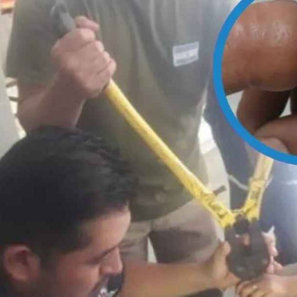 Estos accidentes son muy comunes: En Orán los bomberos sacaron a 30 vecinos anillos que se trabaron en sus dedos