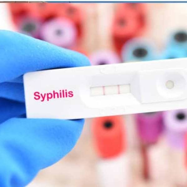 Fuerte aumento de casos de sífilis en Salta: “Ocurrió porque hubo un relajamiento en el uso de los métodos anticonceptivos entre los jóvenes