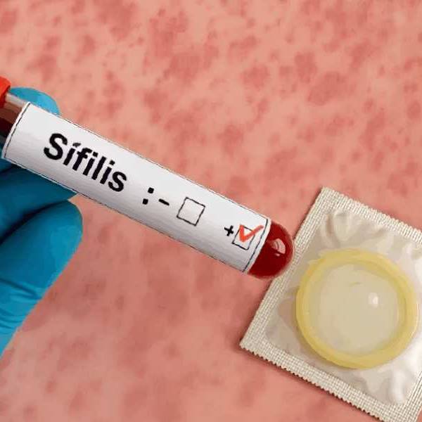Preocupación en Salta por el aumento de casos de sífilis, con fuerte impacto en los jóvenes
