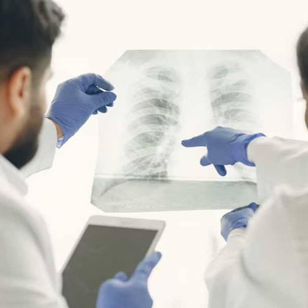 Alerta: Los casos de tuberculosis aumentaron un 65% en Argentina en 5 años